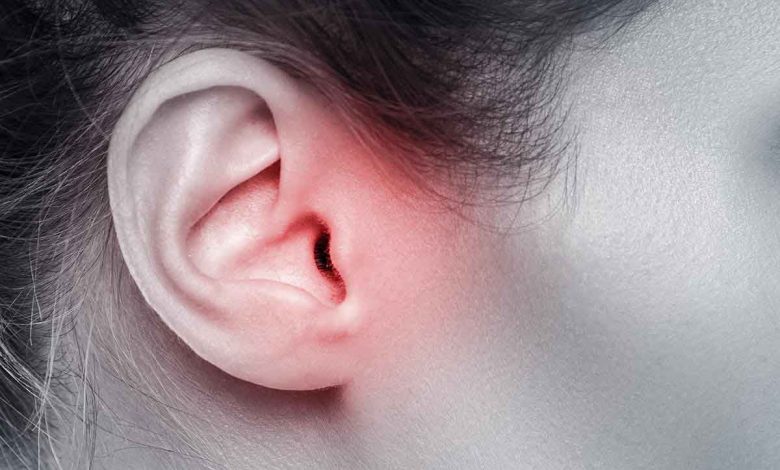با علائم عفونت گوش خارجی و روش درمان آن آشنا شوید