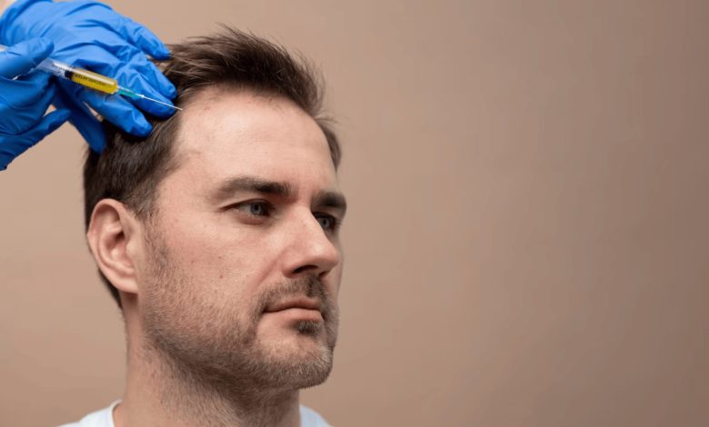 مزوتراپی مو چیست و چگونه انجام می شود؟