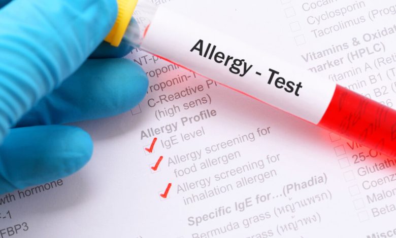 تست آلرژی چگونه است و چرا اهمیت دارد؟