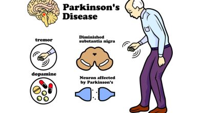 بیماری پارکینسون چیست و چه علائمی دارد؟