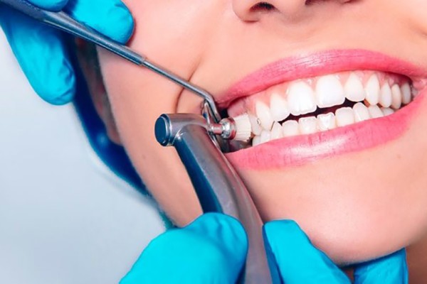 روش های زیباسازی دندان توسط دکتر دندانپزشک
