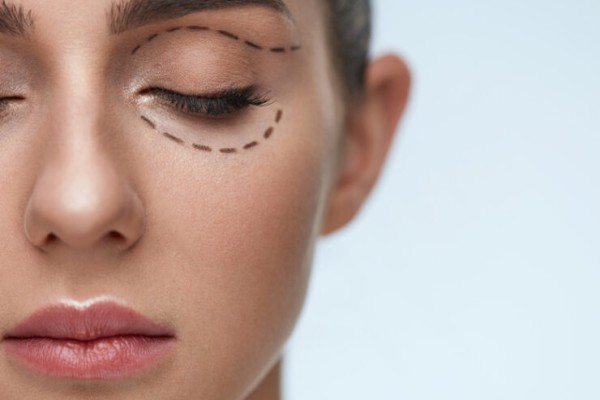 درمان چین و چروک اطراف چشم 